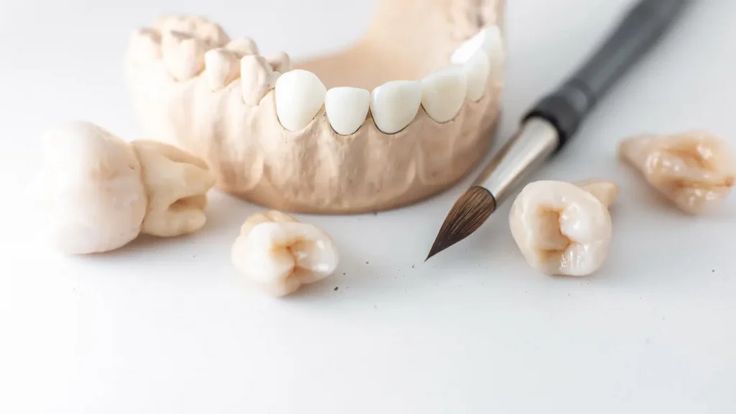 Soins dentaire esthétique en composite antérieur et postérieur 